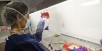 Gene may pinpoint most aggressive prostate cancer
