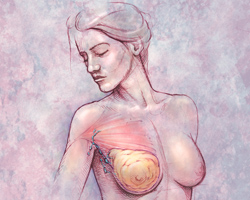 US panel rejects Roche's Avastin for breast cancer